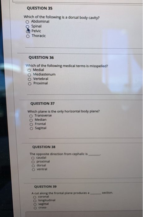 Solved QUESTION 30 Which of the following prefixes means | Chegg.com