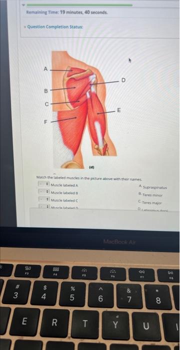 solved-match-the-labeled-muscles-in-the-picture-above-wi