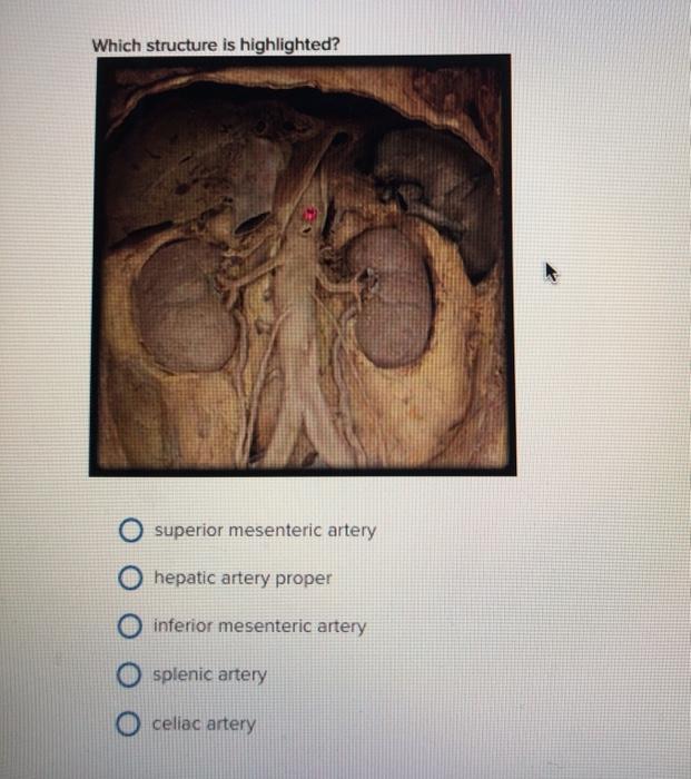 Which structure is highlighted? superior mesenteric artery O hepatic artery proper o inferior mesenteric artery O splenic art