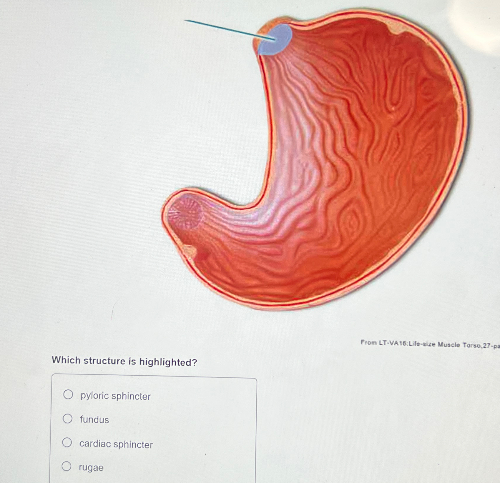 Solved From LT-VA16:Lile-size Muscle Torso, 27-pWhich | Chegg.com
