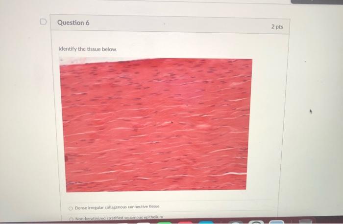 Question 6 2 pts Identify the tissue below. Dense regular collagenous connective the Nanetinized stratified museum