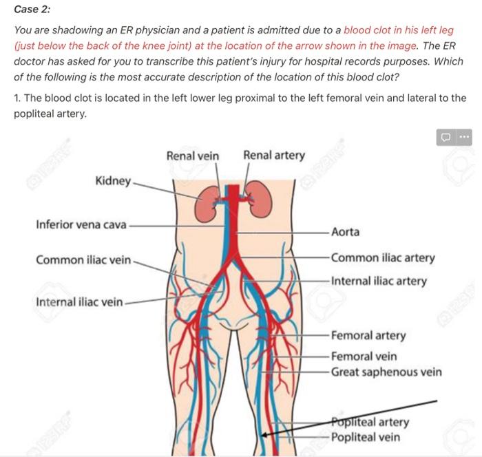 Case 2: You are shadowing an ER physician and a patient is admitted due to a blood clot in his left leg (just below the back
