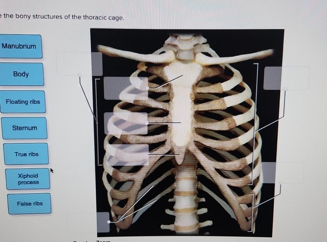 Solved the bony structures of the thoracic cage. | Chegg.com