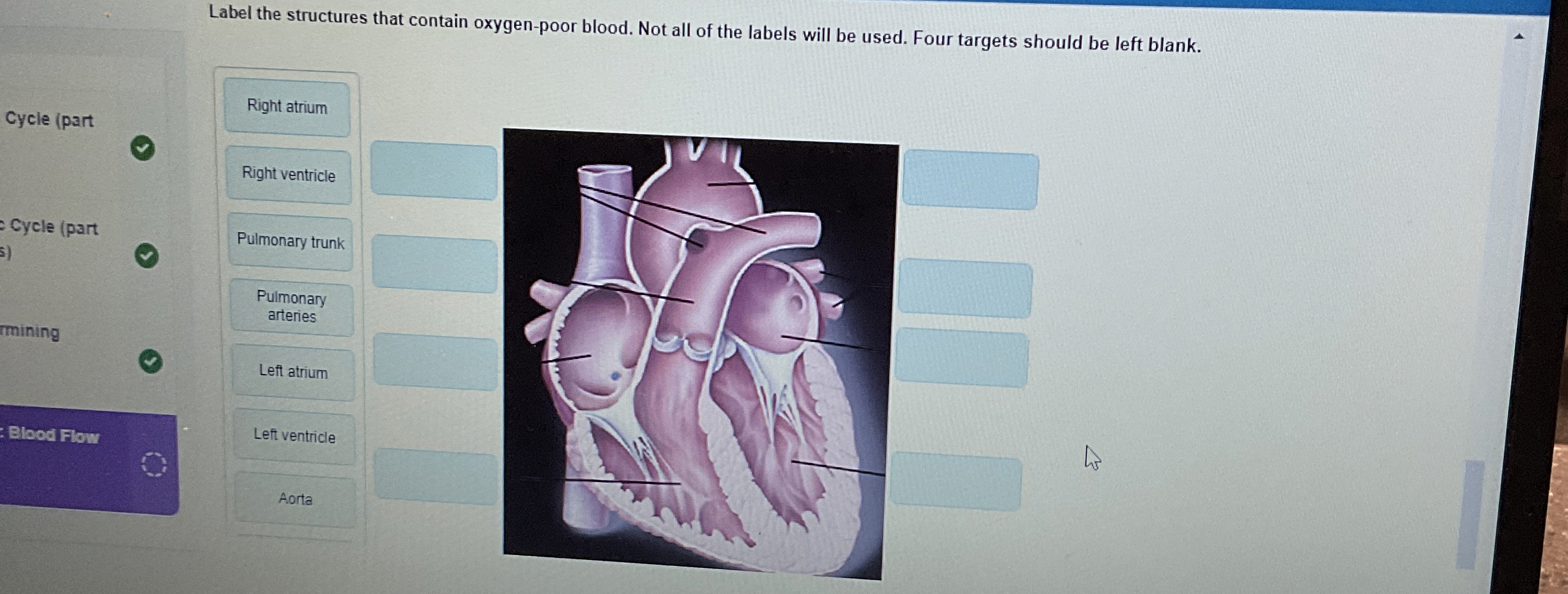 Solved Label the structures that contain oxygen-poor blood. | Chegg.com