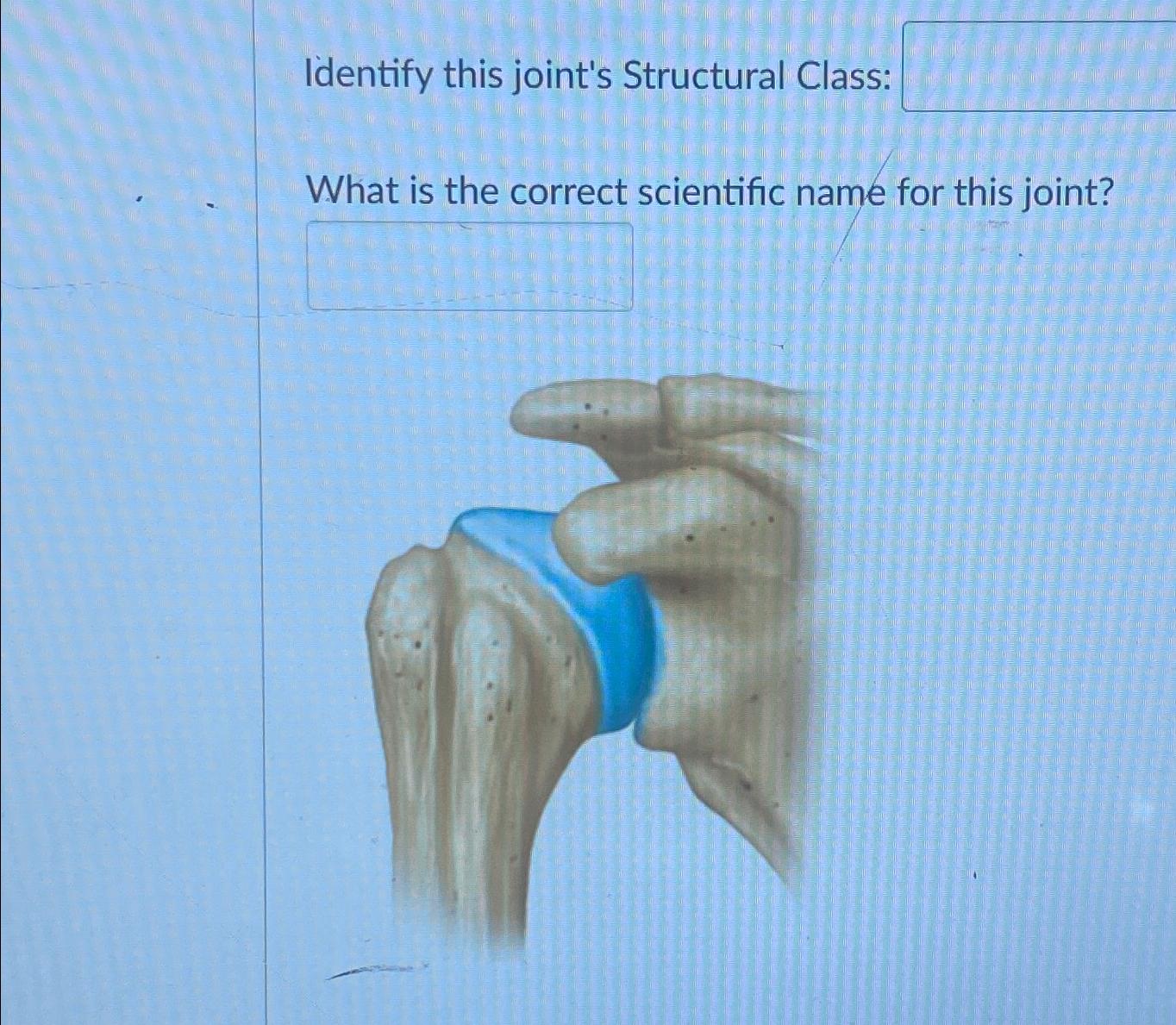 Solved Identify This Joint S Structural Class What Is The Chegg