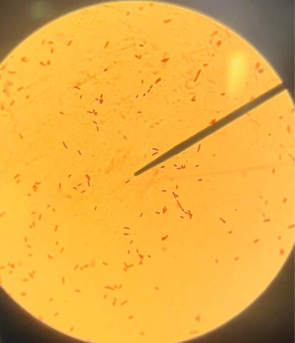 Solved UNKNOWN \#2: (Indicate Tube \#) 1) Gram Staining | Chegg.com