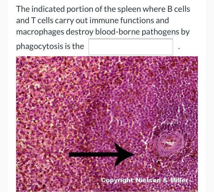 Solved The indicated portion of the spleen where B cells and | Chegg.com