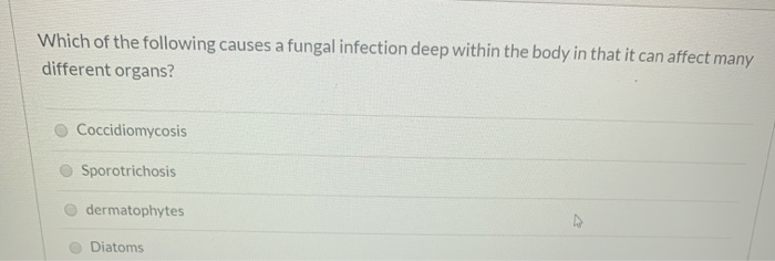 Solved Which of the following statements are FALSE? Protozoa | Chegg.com