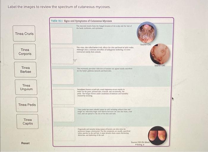 Label the images to review the spectrum of cutaneous