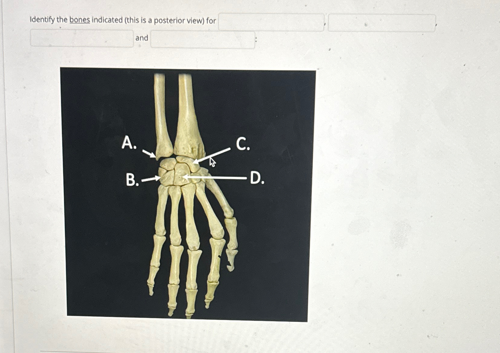 Solved Identify the bones indicated (this is a posterior | Chegg.com