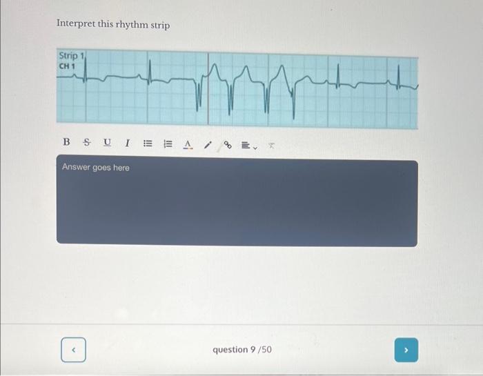 Solved Interpret This Rhythm Strip Interpret This Rhythm | Chegg.com