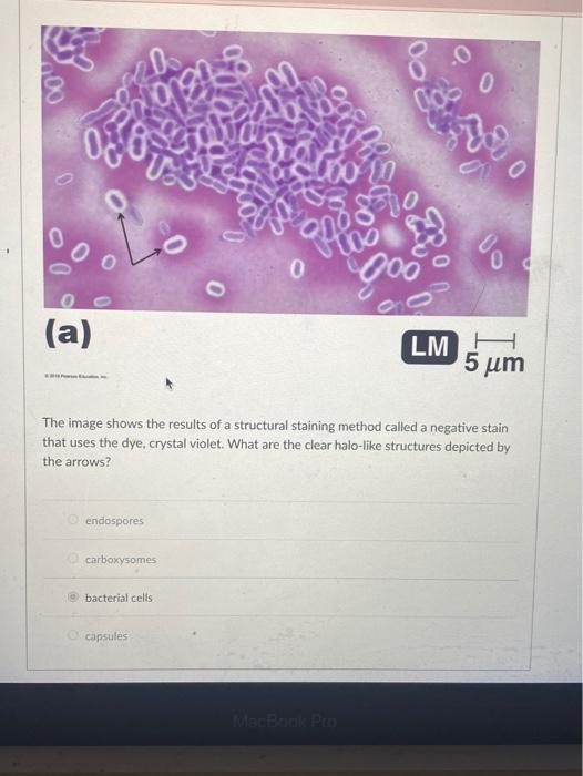 Solved 0 0 africa 0 (a) LM H 5 μm The image shows the | Chegg.com