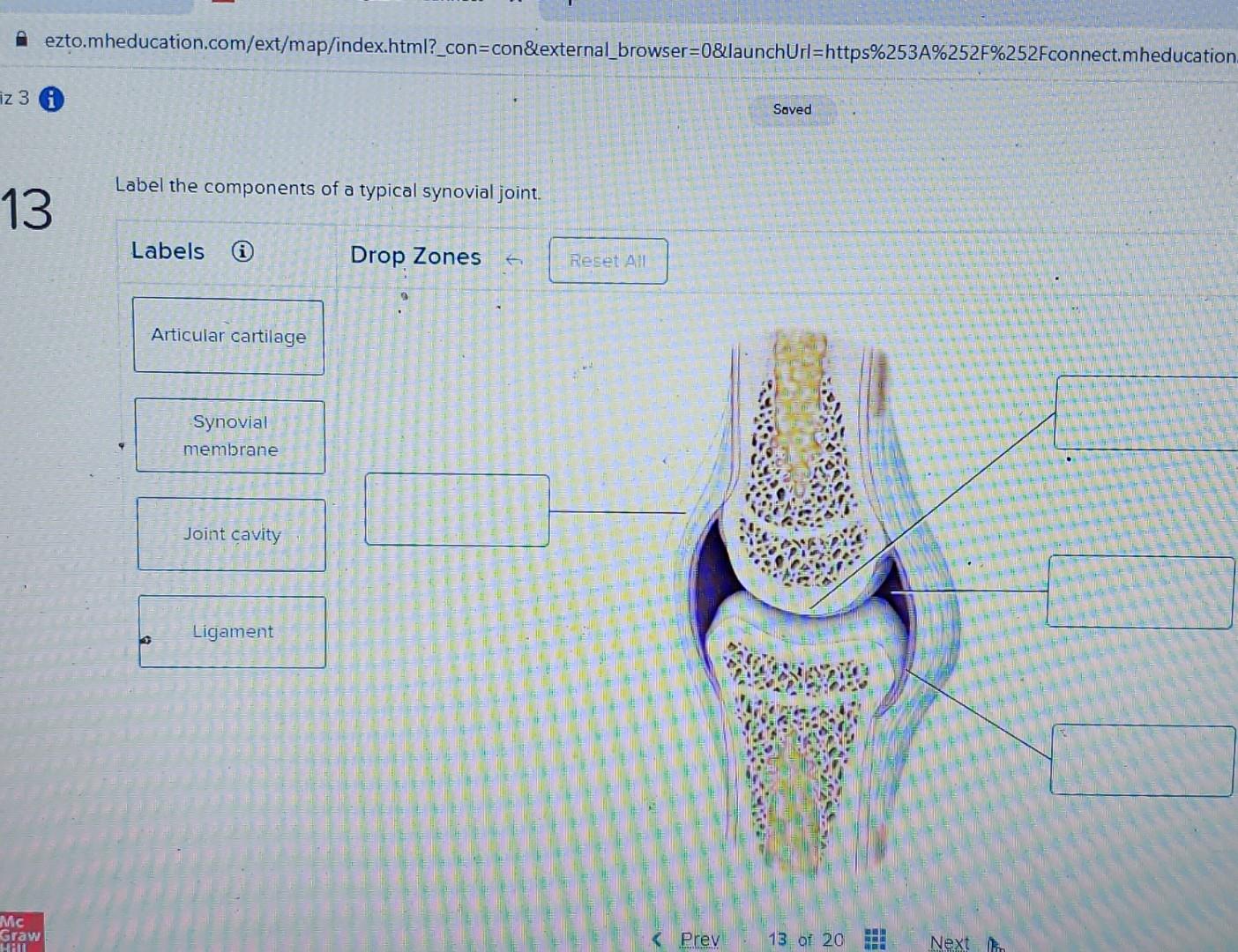 Label The Components Of A Typical Synovial Joint. | Chegg.com