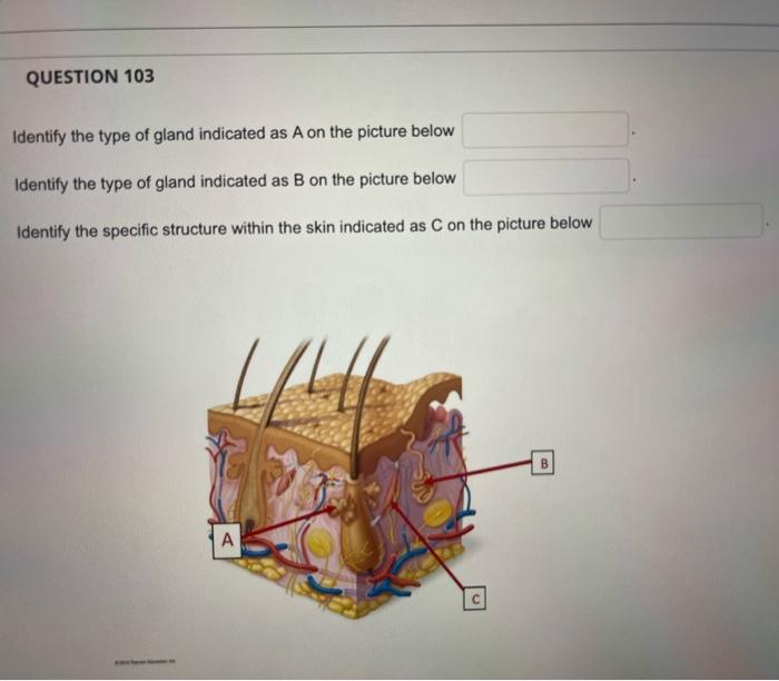 Identify the type of gland indicated as \( \mathrm{A} \) on the picture below
Identify the type of gland indicated as B on th