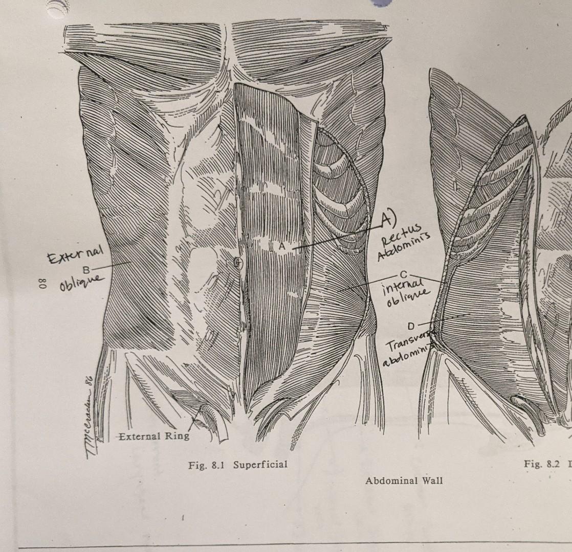 LA) Rectus Abdominis B- External o oblique internal | Chegg.com