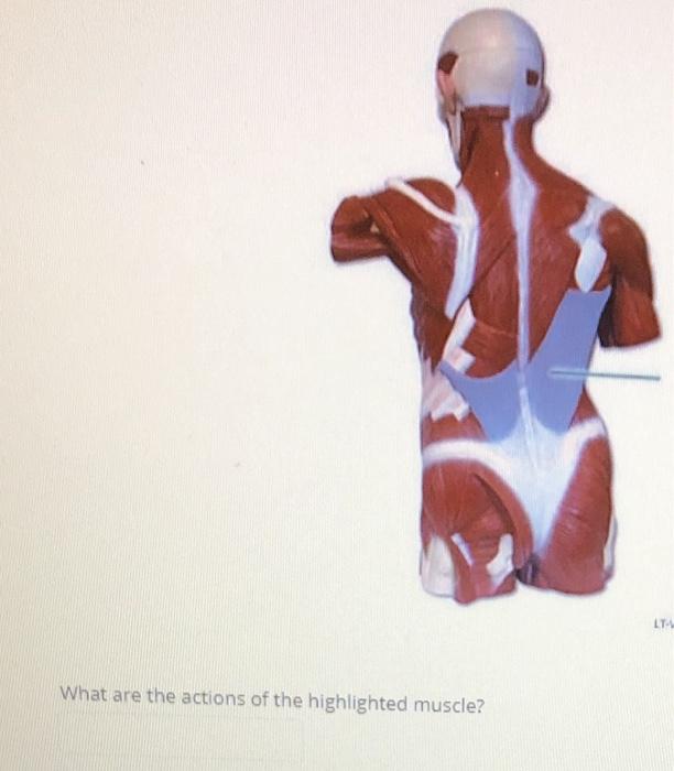 Solved Identify the highlighted muscle. LT What are the | Chegg.com