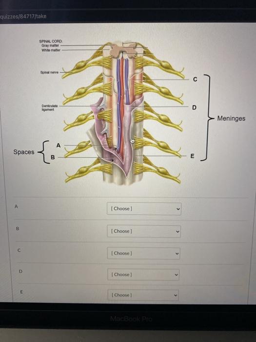 Solved quizzes/84717/take SPINAL CORD Graymar White matter | Chegg.com