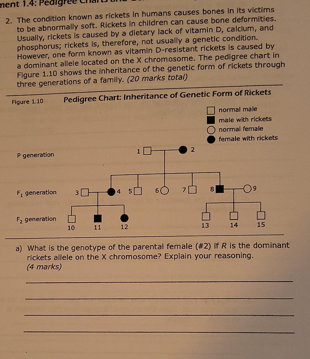 Solved ment 1.4: Pedig 2. The condition known as rickets in | Chegg.com