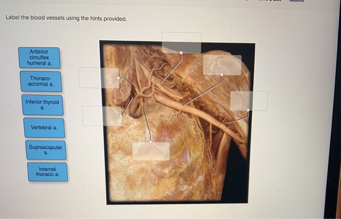 Solved Label the blood vessels using the hints provided. | Chegg.com