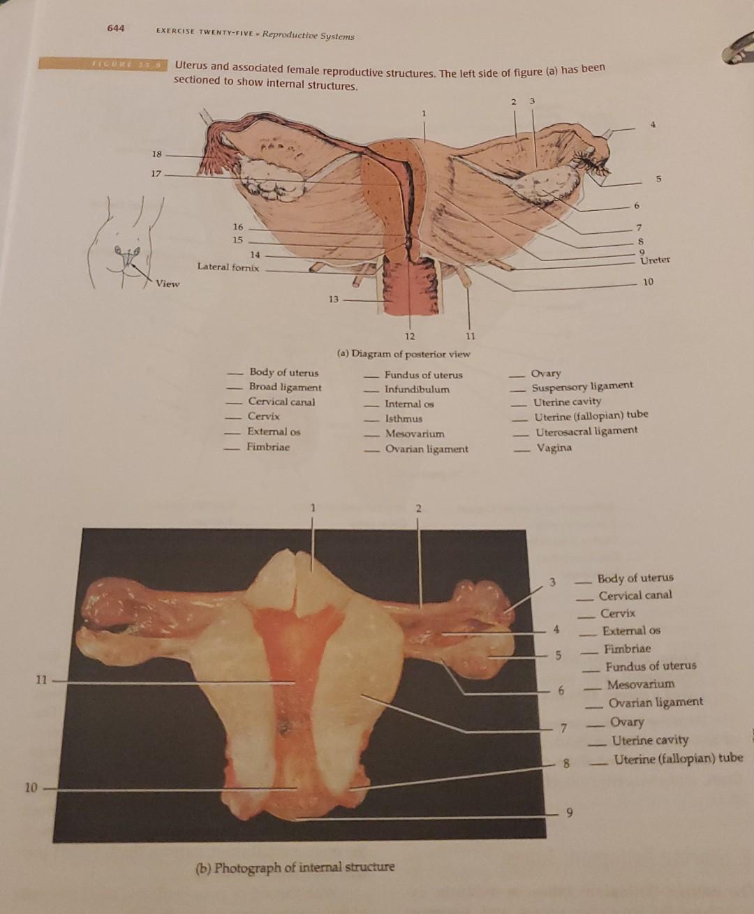 Solved ribuint 23− Uterus and assodiated female reproductive | Chegg.com