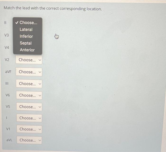 Solved Match the lead with the correct corresponding | Chegg.com