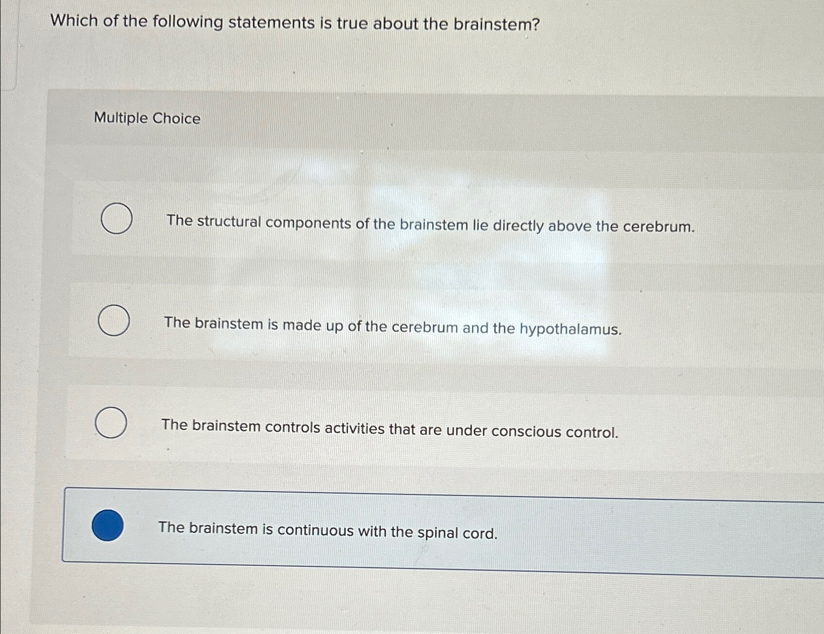 Which of the following statements is true about the | Chegg.com