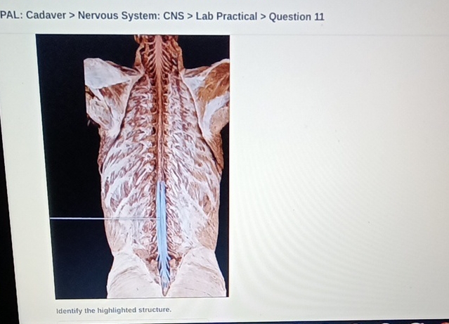 Solved by an EXPERT PAL: Cadaver &gt; ﻿Nervous System: CNS &gt; ﻿Lab Practical | Chegg.com