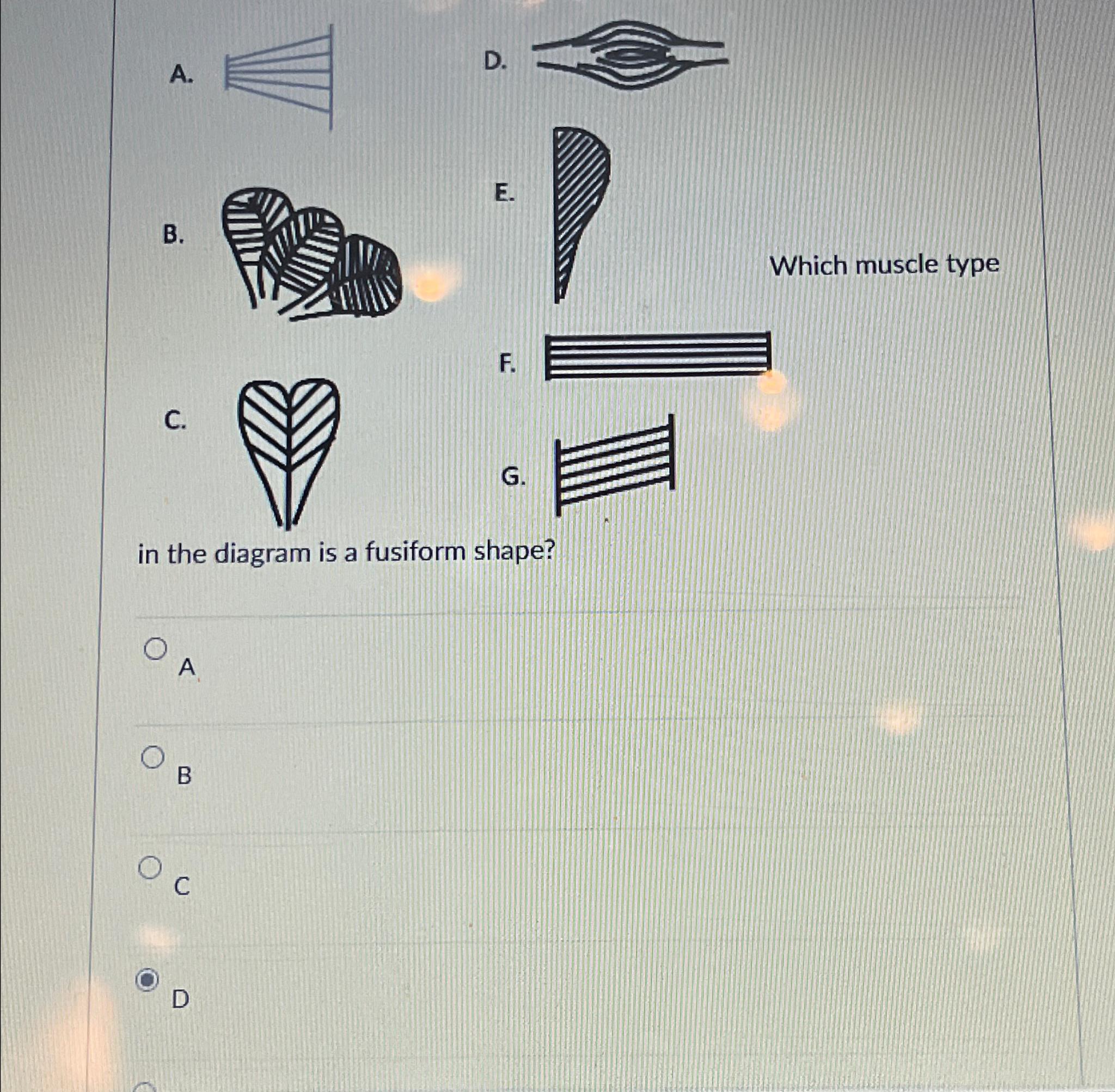 Solved Out of all the options which muscle type in the | Chegg.com