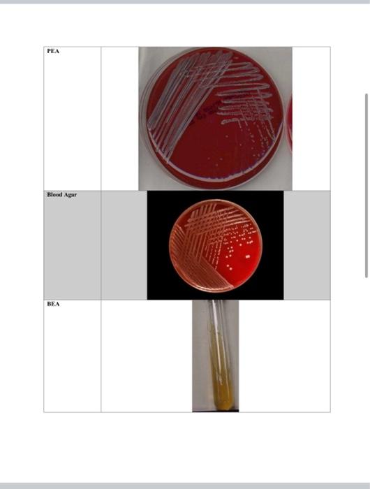 Solved Test Gram Stain Picture Of Results Tsa Plate Be Sim 