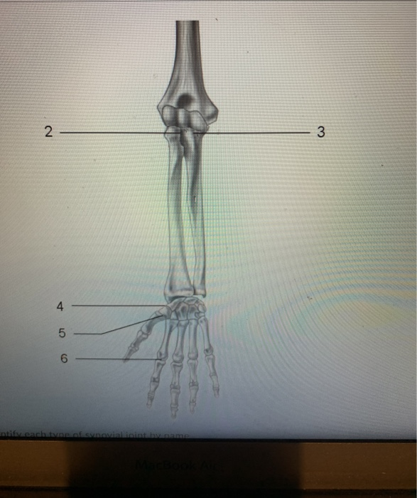 Solved Nts) Com Identify Each Type Of Synovial Joint By | Chegg.com