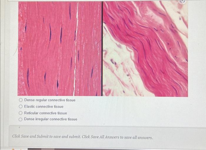 Solved What type of Tissue is this OPTIONS BELOW O Dense
