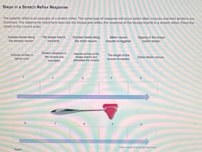 solved-steps-in-a-stretch-reflex-response-the-patellar-chegg
