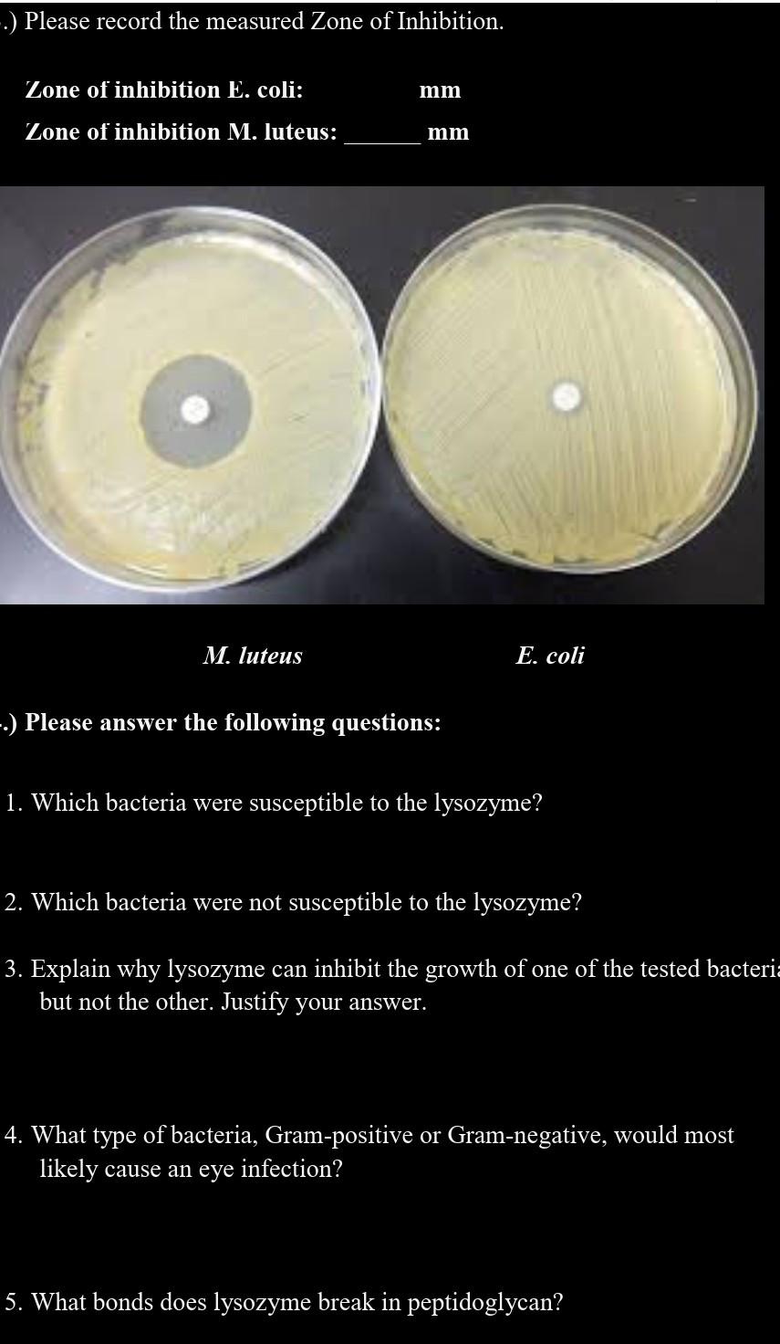 solved-please-record-the-measured-zone-of-inhibition-chegg