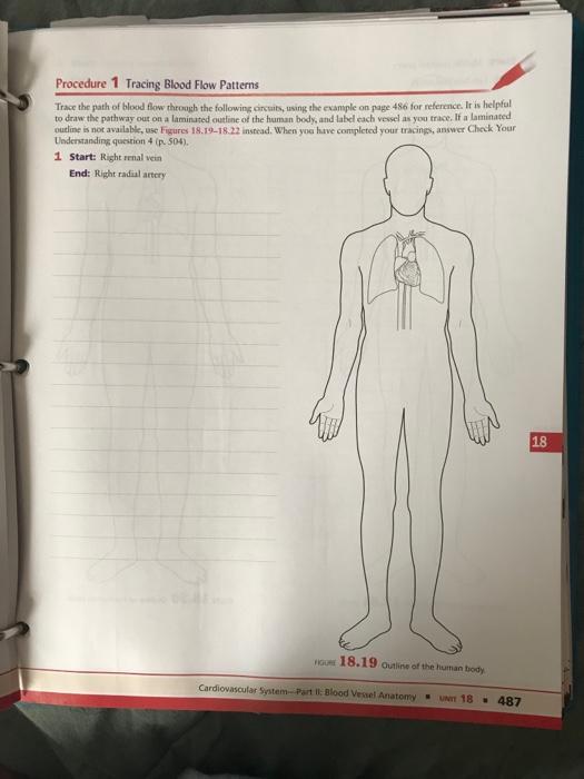 Solved Procedure 1 Tracing Blood Flow Patterns Trace the | Chegg.com