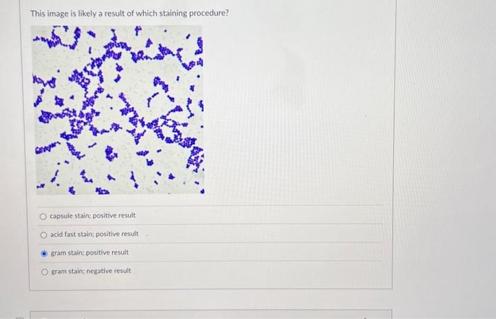 Solved Endospore Stain; Negative Capsule; Positive Acid | Chegg.com