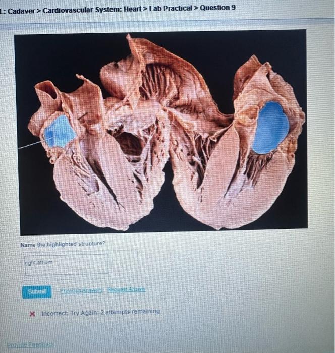 L: Cadaver> Cardiovascular System: Heart> Lab Practical > Question 9