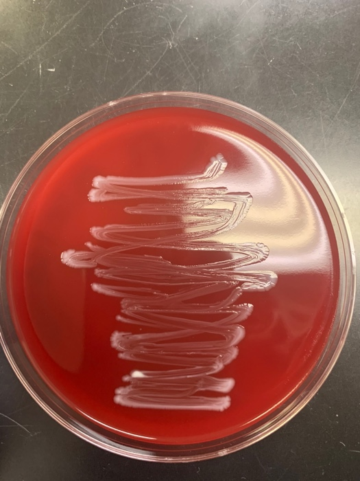 Solved Blood Agar. which of the following is | Chegg.com