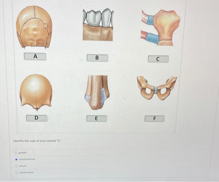 Solved Identify the type of joint labeled " C : Eomph | Chegg.com