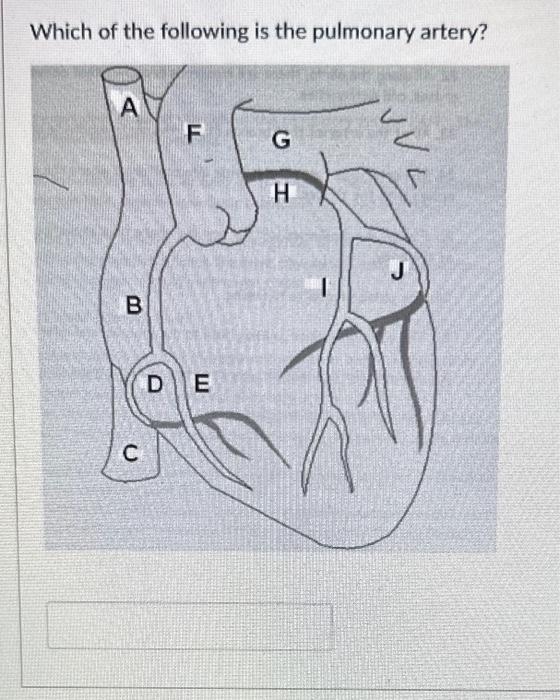 Solved Which of the following is the pulmonary artery? | Chegg.com