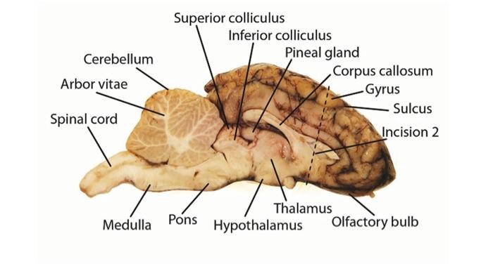 arbor vitae of cerebellum