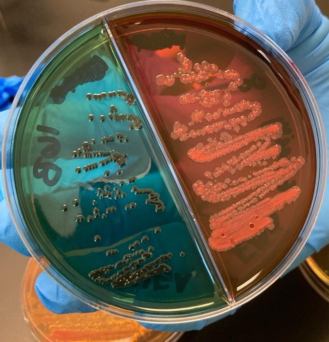 Solved Identify the bacterias in the following 4 agar | Chegg.com