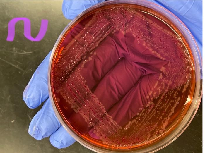 Solved From an unknow bacteria this EMB plate came out and | Chegg.com