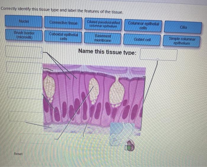 solved-correctly-identify-this-tissue-type-and-label-the-chegg