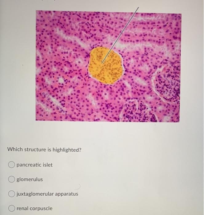 Solved Which structure is highlighted? pancreatic islet | Chegg.com