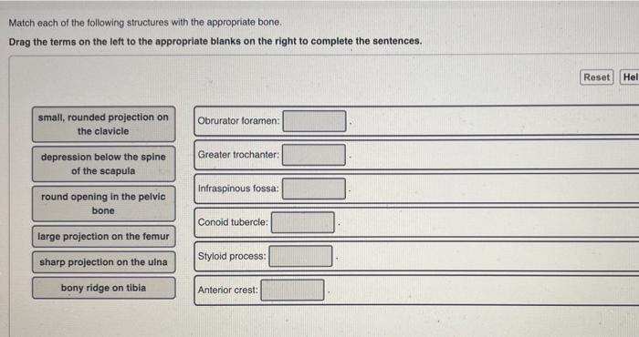 Solved Match each of the following structures with the | Chegg.com