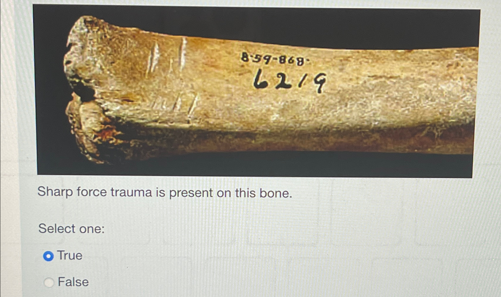 Sharp force trauma is present on this bone.Select | Chegg.com