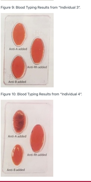 FOUNDATIONS OF BIOLOGY I 70261 Activity 4: Blood | Chegg.com