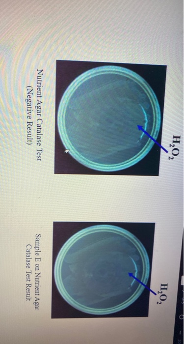 Solved Identifying Your Unknown Bacteria Step 1: Gram Stain | Chegg.com