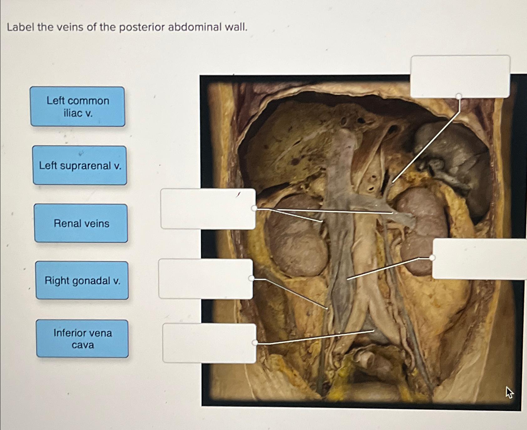 Solved Label the veins of the posterior abdominal wall fill | Chegg.com