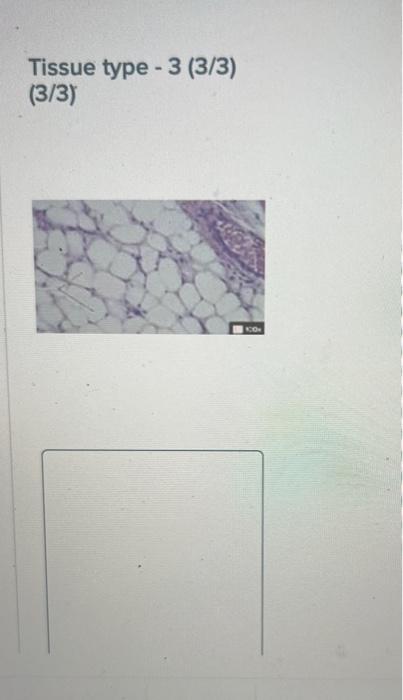 Solved Determine which connective tissue type each image | Chegg.com
